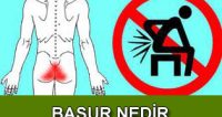 hemoroid basur nedir ve korunma yolları