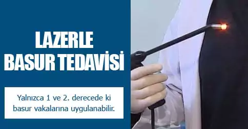 lazerle basur tedavisi