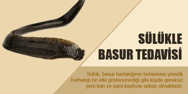 sülükle basur tedavisi