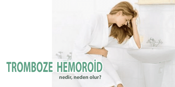 tromboze hemoroid